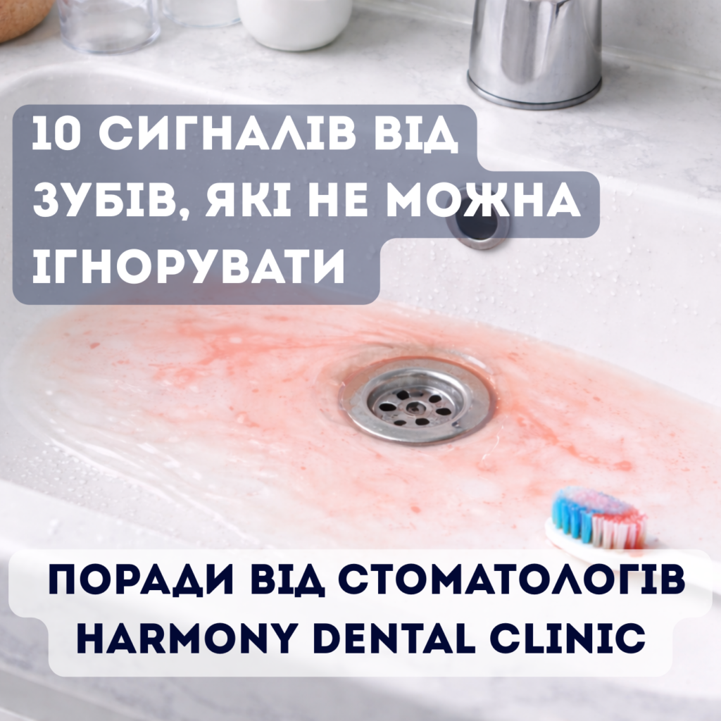 10 сигналів від зубів, які не можна ігнорувати — поради Harmony Dental стоматологія Печерськ